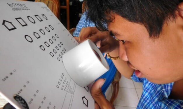 Cambodian child with magnifier taking a low vision assessment
